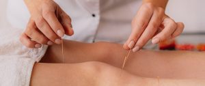 Boost Your Lymphatic Health with Acupuncture